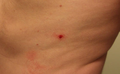 Medizinischer Blutegel Hirudo medicinalis - Bild 5